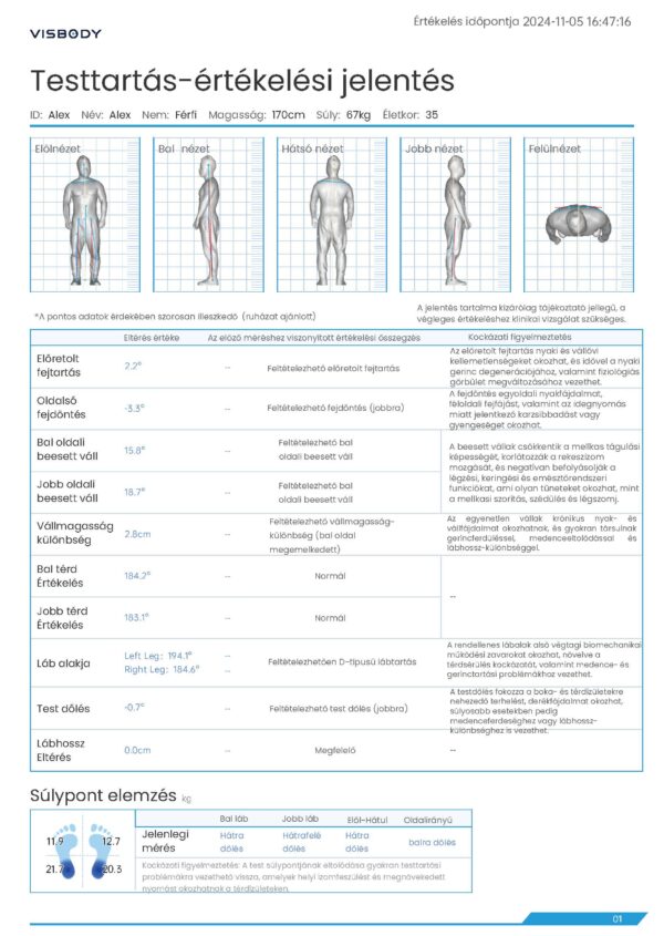 Visbody-R60 Gerincferdülés,Medenceértékelés Diagnosztika,Súlypont- és Egyensúly-elemzés Scanner - Image 2