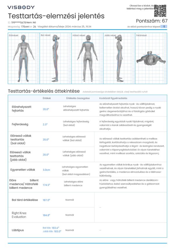 Visbody-S30 BIA+3D fúziós technológia, Orvosi pontosságú Testösszetétel-Testtartás Scanner - Image 10