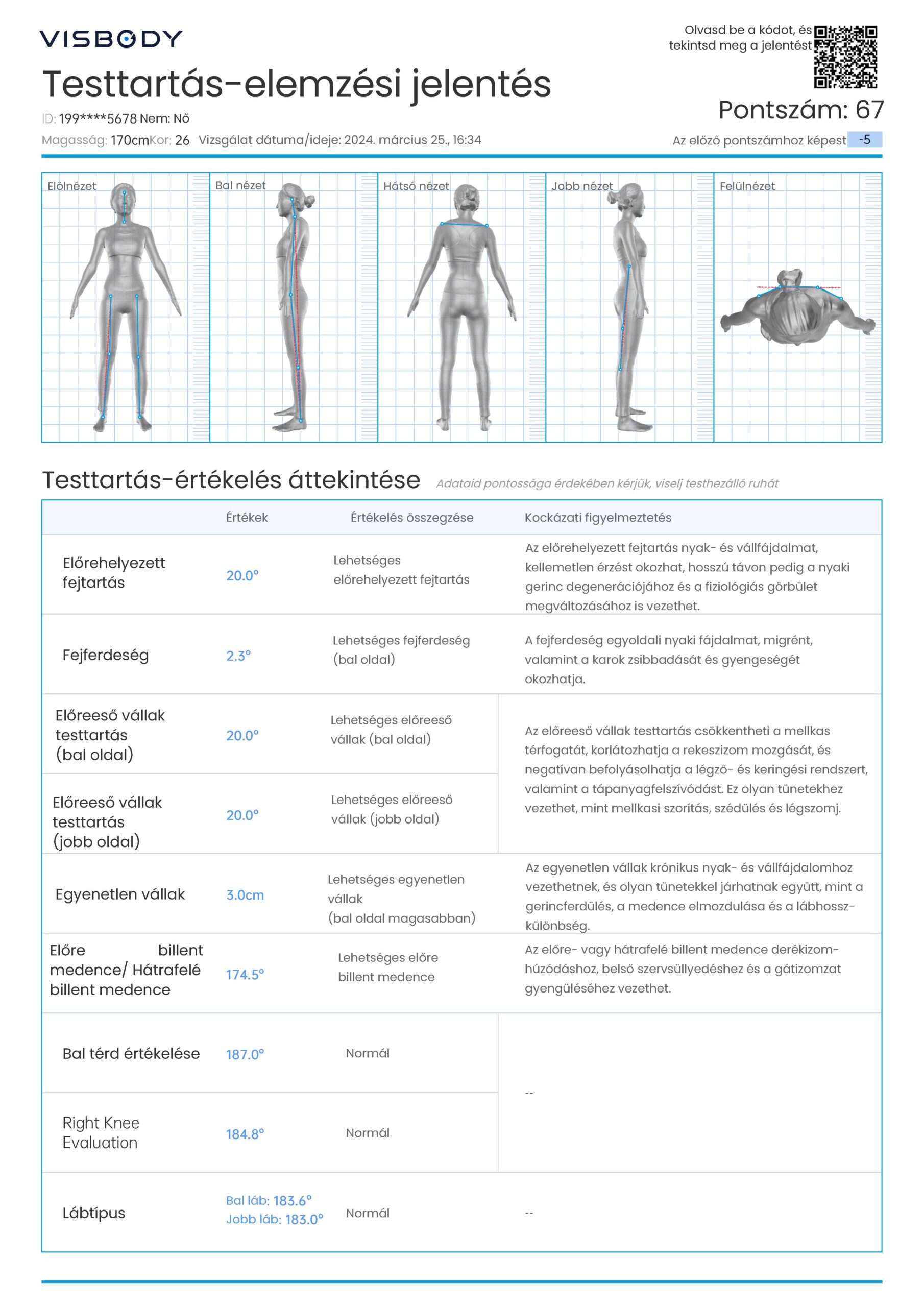 Visbody-S30 BIA+3D fúziós technológia, Orvosi pontosságú Testösszetétel-Testtartás Scanner - Image 10