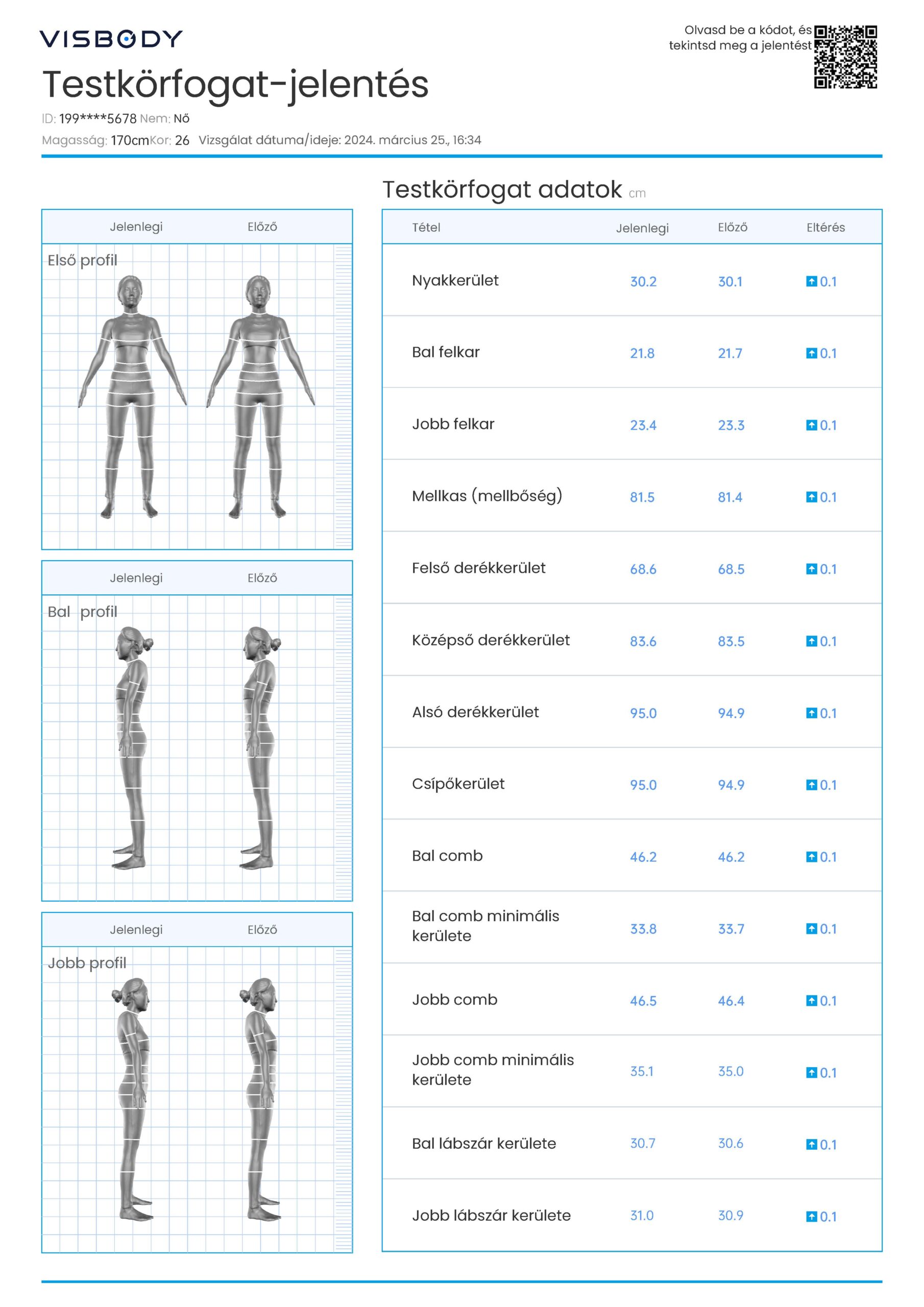 Visbody-S30 BIA+3D fúziós technológia, Orvosi pontosságú Testösszetétel-Testtartás Scanner - Image 11